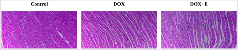 biomedres-openaccess-journal-bjstr
