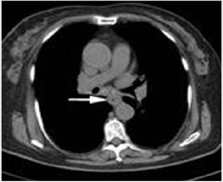 biomedres-openaccess-journal-bjstr
