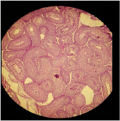 biomedres-openaccess-journal-bjstr