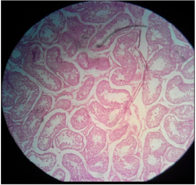 biomedres-openaccess-journal-bjstr