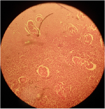 biomedres-openaccess-journal-bjstr