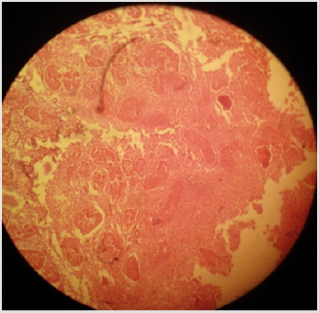 biomedres-openaccess-journal-bjstr