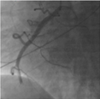 biomedres-openaccess-journal-bjstr