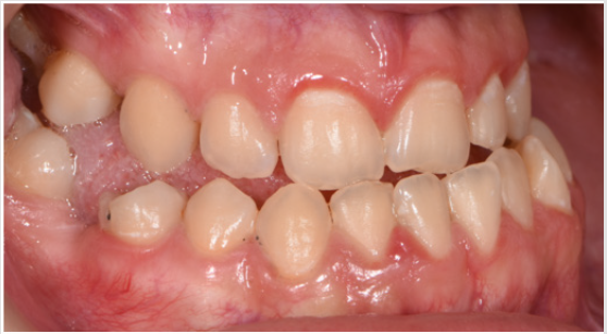 biomedres-openaccess-journal-bjstr