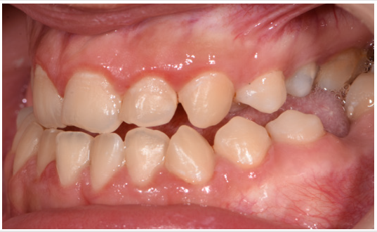 biomedres-openaccess-journal-bjstr