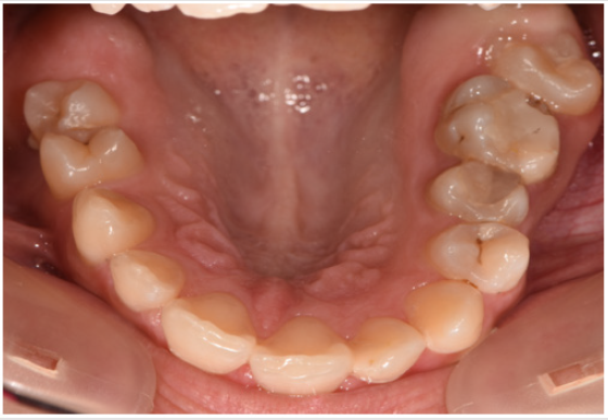 biomedres-openaccess-journal-bjstr
