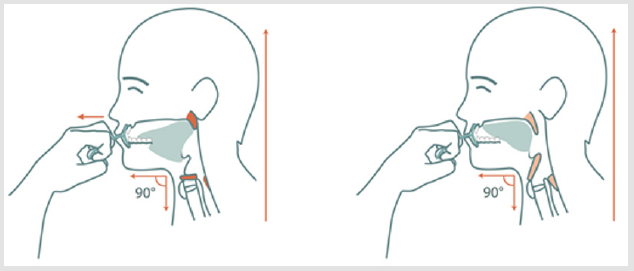 biomedres-openaccess-journal-bjstr