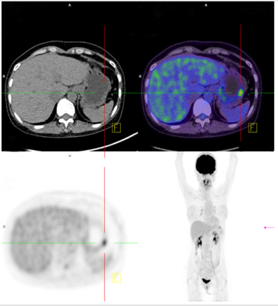 biomedres-openaccess-journal-bjstr