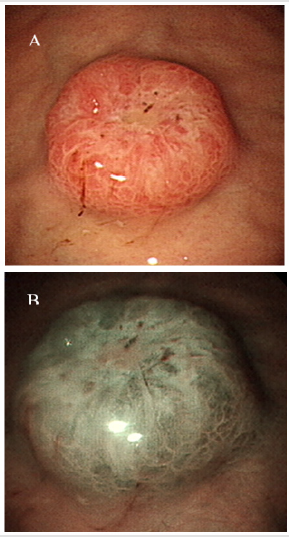 biomedres-openaccess-journal-bjstr