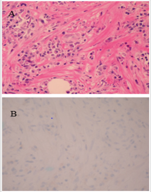 biomedres-openaccess-journal-bjstr