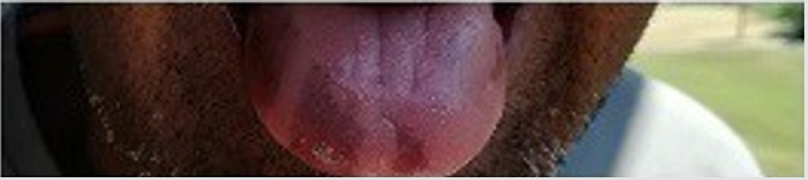 biomedres-openaccess-journal-bjstr