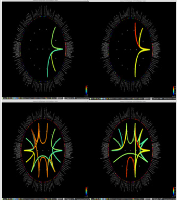 biomedres-openaccess-journal-bjstr