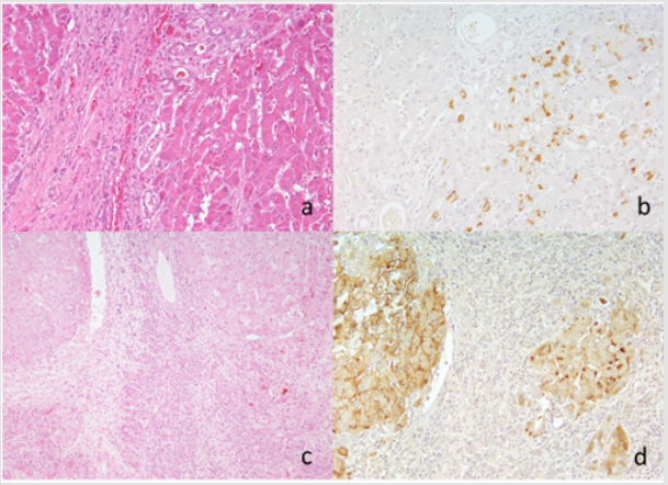 biomedres-openaccess-journal-bjstr