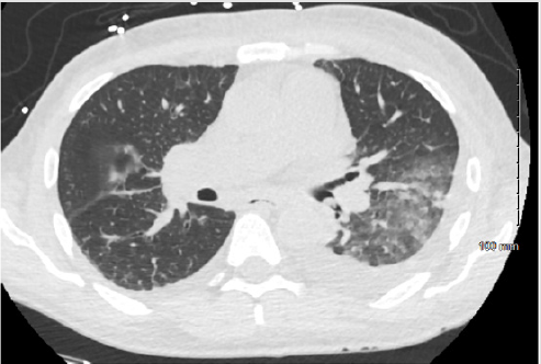 biomedres-openaccess-journal-bjstr