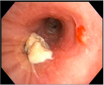 biomedres-openaccess-journal-bjstr