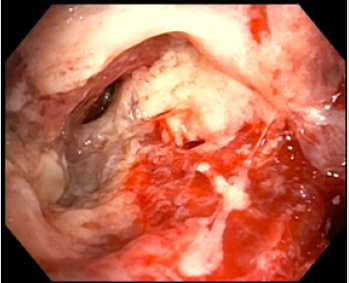 biomedres-openaccess-journal-bjstr