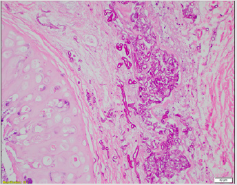 biomedres-openaccess-journal-bjstr