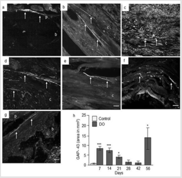 biomedres-openaccess-journal-bjstr