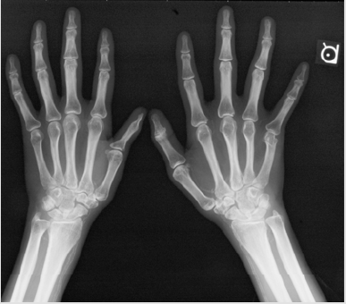 biomedres-openaccess-journal-bjstr