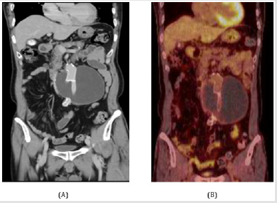 biomedres-openaccess-journal-bjstr