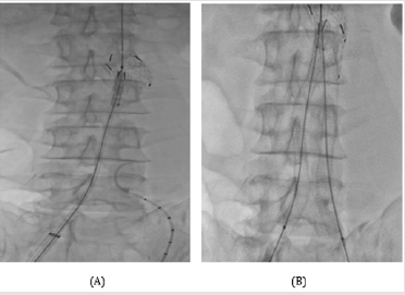 biomedres-openaccess-journal-bjstr