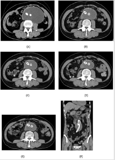 biomedres-openaccess-journal-bjstr