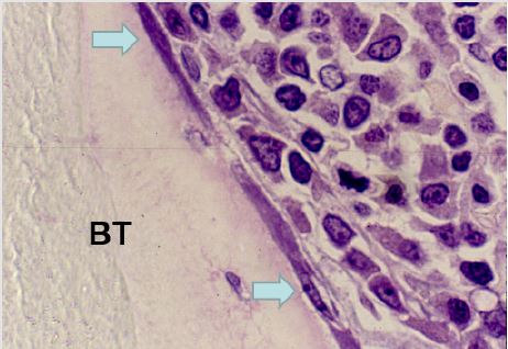 biomedres-openaccess-journal-bjstr