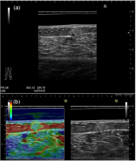 biomedres-openaccess-journal-bjstr