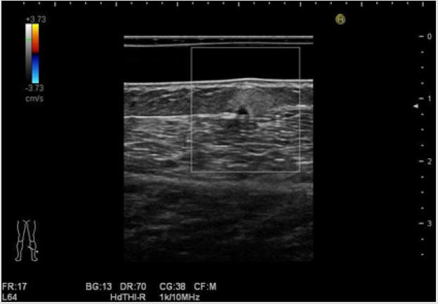 biomedres-openaccess-journal-bjstr