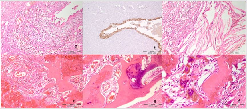 biomedres-openaccess-journal-bjstr