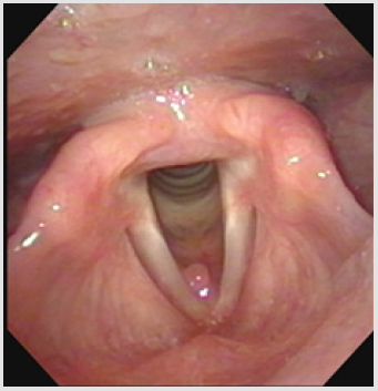 biomedres-openaccess-journal-bjstr