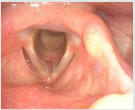 biomedres-openaccess-journal-bjstr