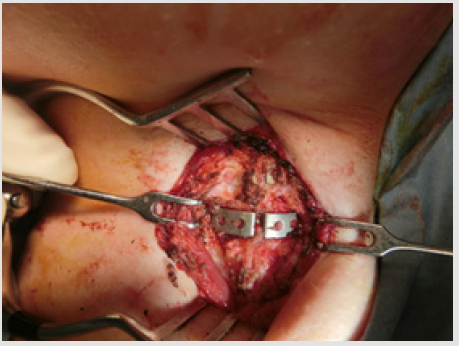 biomedres-openaccess-journal-bjstr