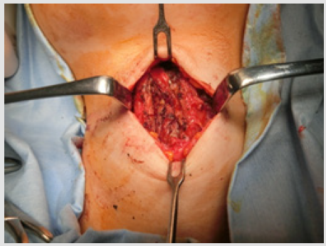 biomedres-openaccess-journal-bjstr