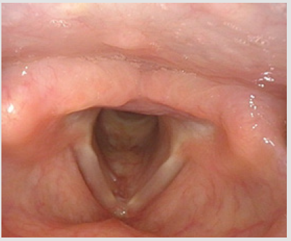 biomedres-openaccess-journal-bjstr