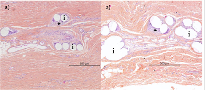 biomedres-openaccess-journal-bjstr