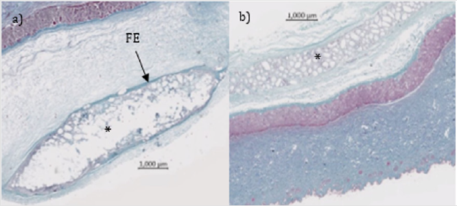biomedres-openaccess-journal-bjstr