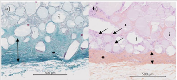 biomedres-openaccess-journal-bjstr