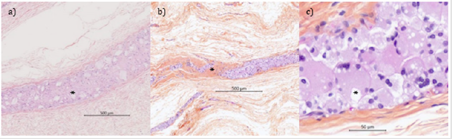 biomedres-openaccess-journal-bjstr