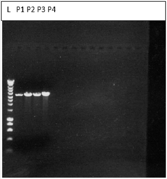biomedres-openaccess-journal-bjstr