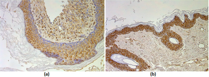 biomedres-openaccess-journal-bjstr