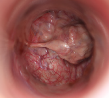 biomedres-openaccess-journal-bjstr