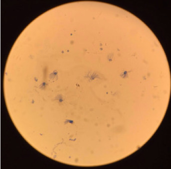 biomedres-openaccess-journal-bjstr