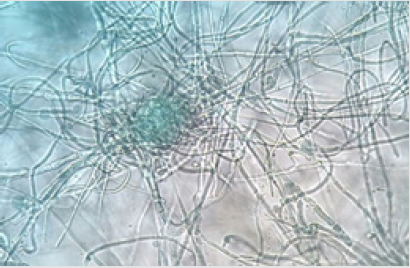 biomedres-openaccess-journal-bjstr