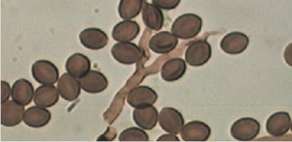 biomedres-openaccess-journal-bjstr