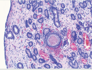 biomedres-openaccess-journal-bjstr