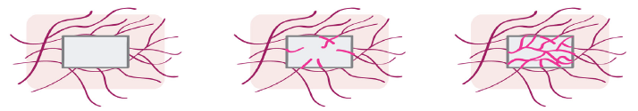biomedres-openaccess-journal-bjstr