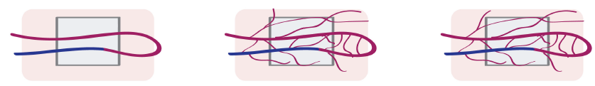 biomedres-openaccess-journal-bjstr
