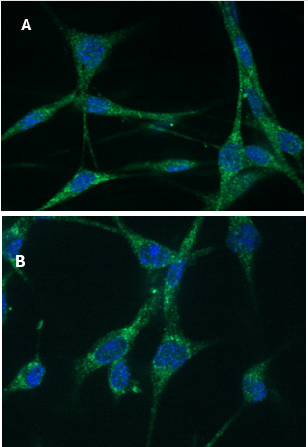 biomedres-openaccess-journal-bjstr