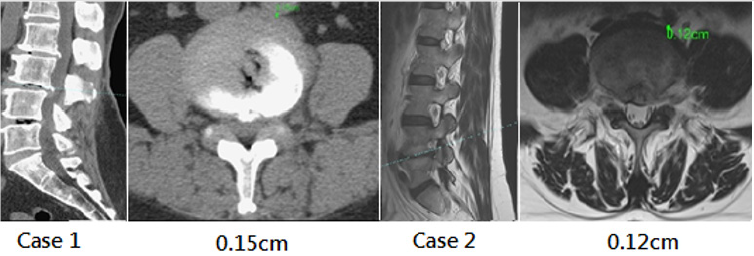 biomedres-openaccess-journal-bjstr